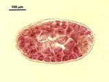 2 - Cellule midollari con ispessimenti lenticolari